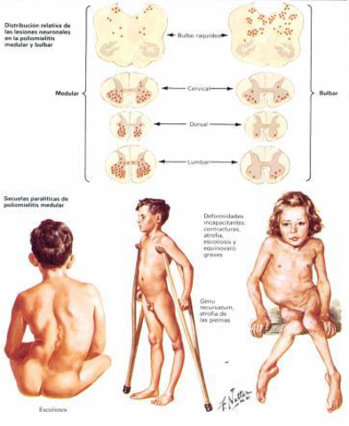 Primeros servicios de medicina física y rehabilitación