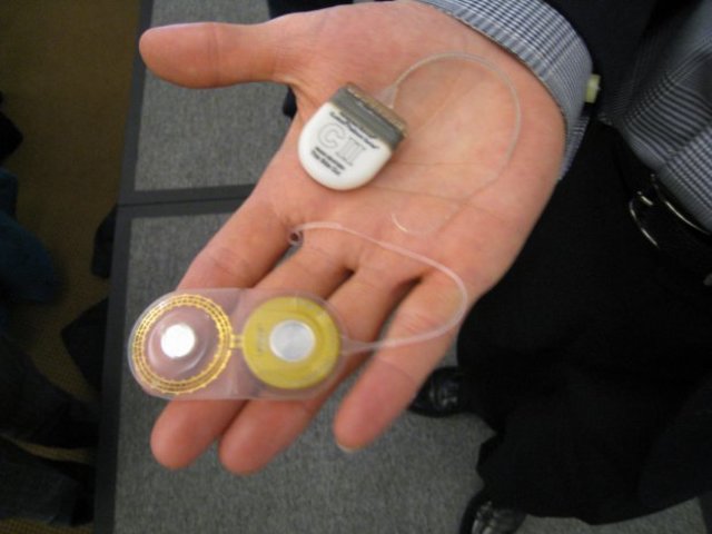 Implantes neuronales