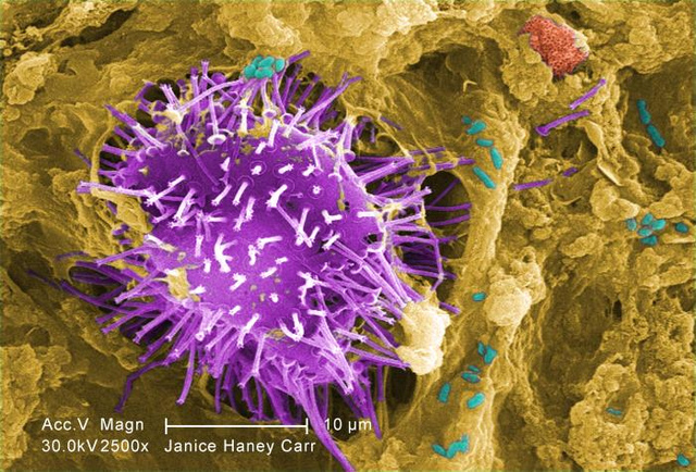 Bacteria and Protozoa