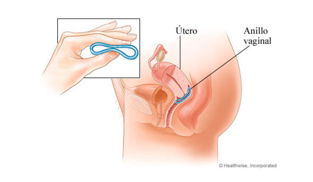 SIGLO XX: DISPOSITIVOS ANILLO
