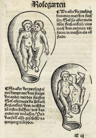 76 a.c (Médico Sorano de Efeso)