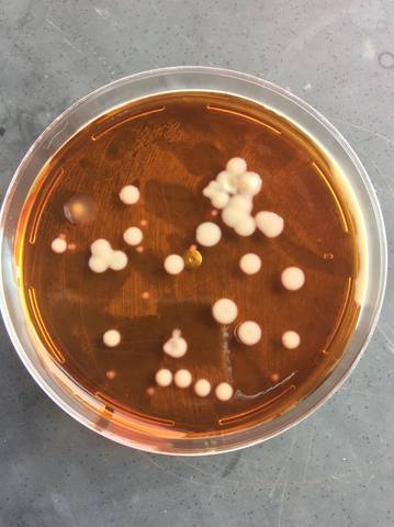 Aislamiento de Streptococcus mutans a partir de muestras tomadas de cepillos de dientes usados