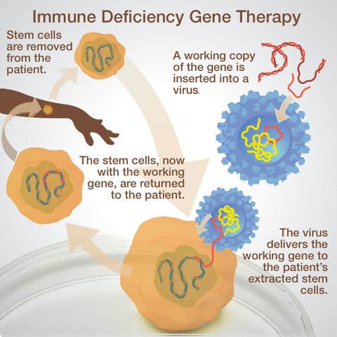 The First Federally Approved Gene Therapy Treatment