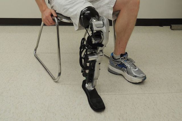 Nervous System-Controlled Bionic Leg