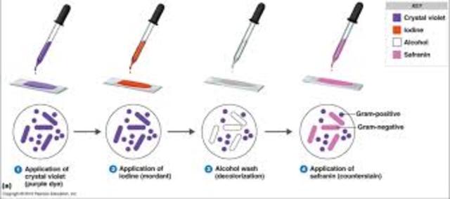 Staining Bacteria