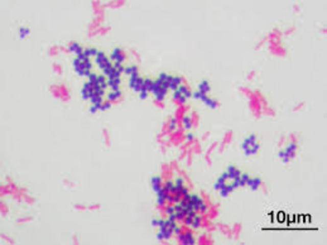 Technique for staining bacteria is created