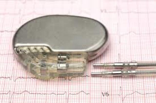 First Pacemaker is Created