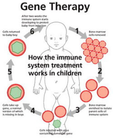 Gene therapy treatment