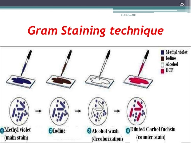 Staining Bacteria for Identification
