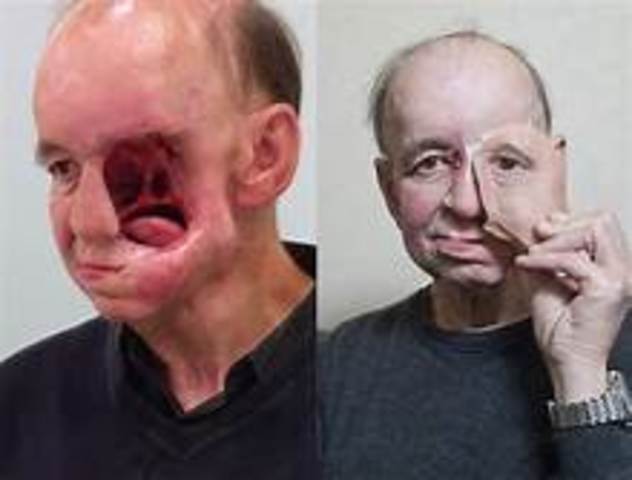 3-D Printers are being used to print skin