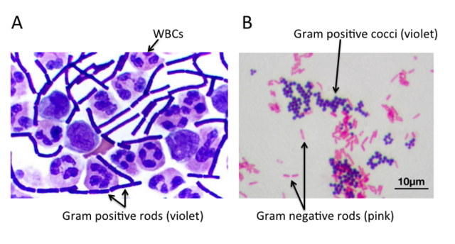IDENTIFICATION OF BACTERIA ENHANCED