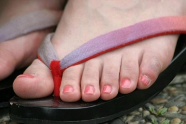 David meets Sophie, who has six toes on each foot