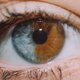 Heterchromia eyes