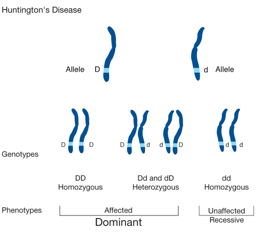 Huntington's disease