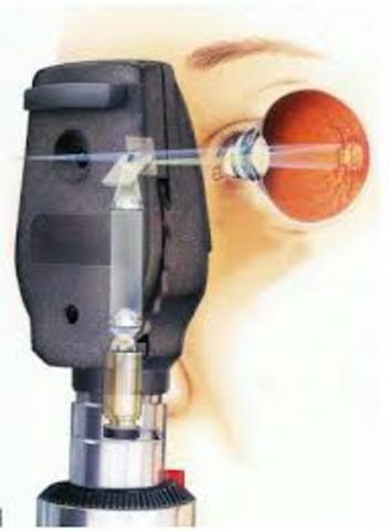 OFTALMOSCÓPIO DIRECTO