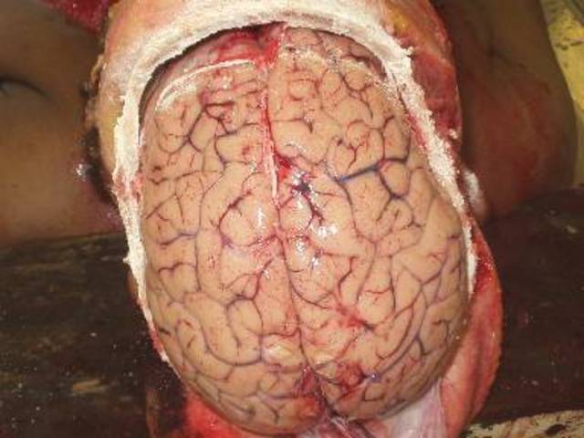 origen de los trastornos