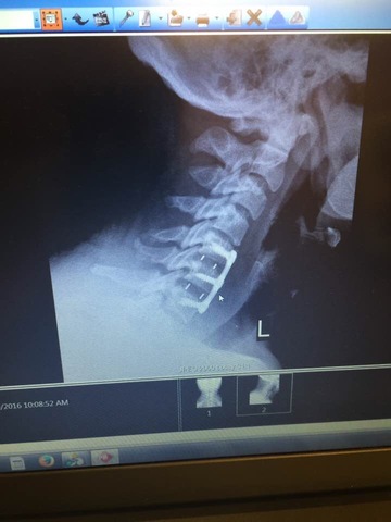 The Plan Takes a Detour