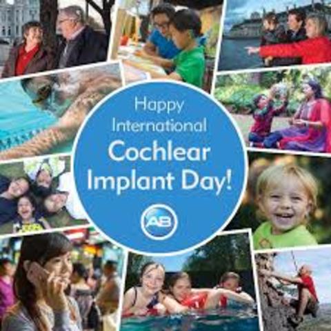 Cochlear Implant Available For Commercial Use In 1971