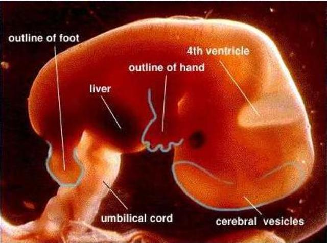 The second month (First trimester)