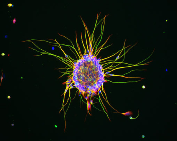 First Multi Celled Organisms