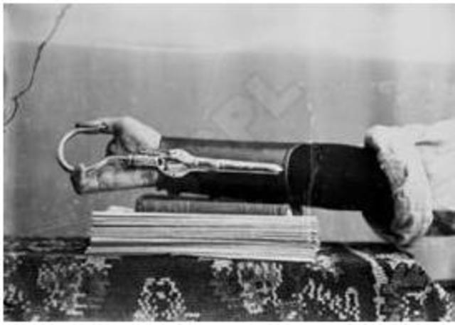 se crea el primer brazo robotico