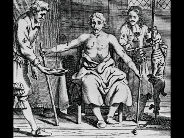 Primera transfusión de sangre