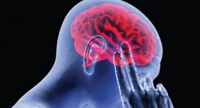 Marie et al, utilización  término planotopoquinesia