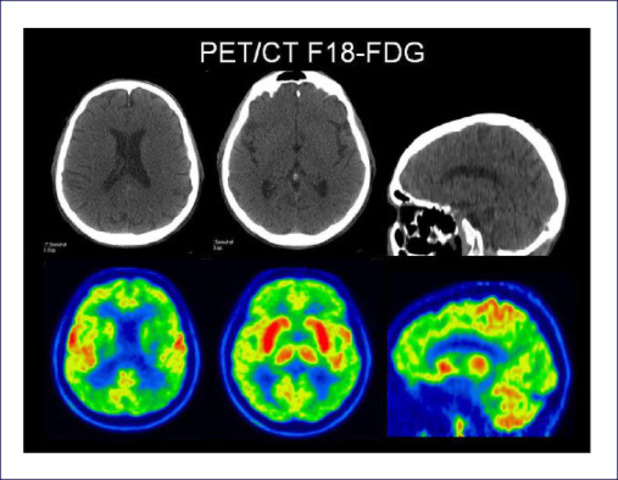 Avances tecnológicos para la neuropsicología