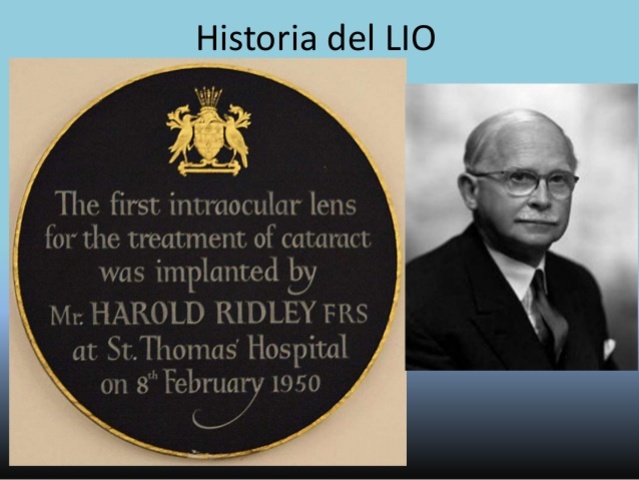 Historia del lente intraocular