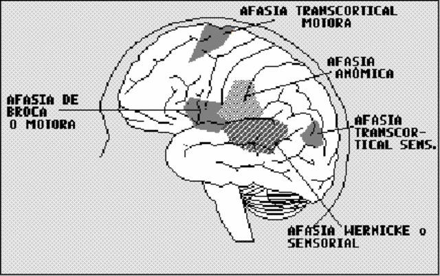 Freud, su primer trabajo publicado sobre psicopatologia
