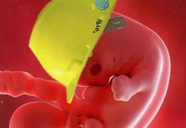 Antes de llegar al mundo