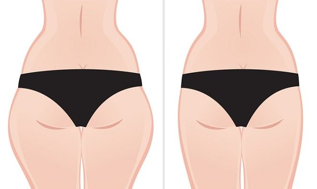 ENSANCHAMIENTO DE LAS CADERAS