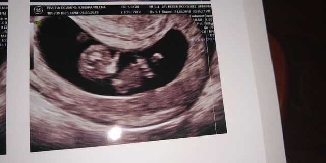 My Baby ...LOADING 50%