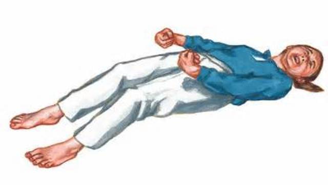 se creía que las convulsiones curaban la esquizofrenia