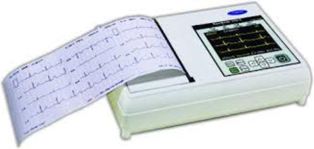 ECG