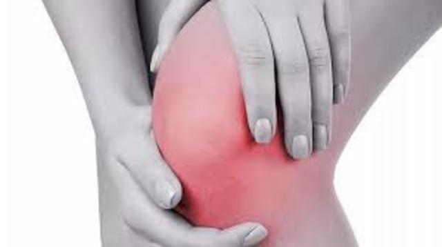 Fractura de mi rodilla.