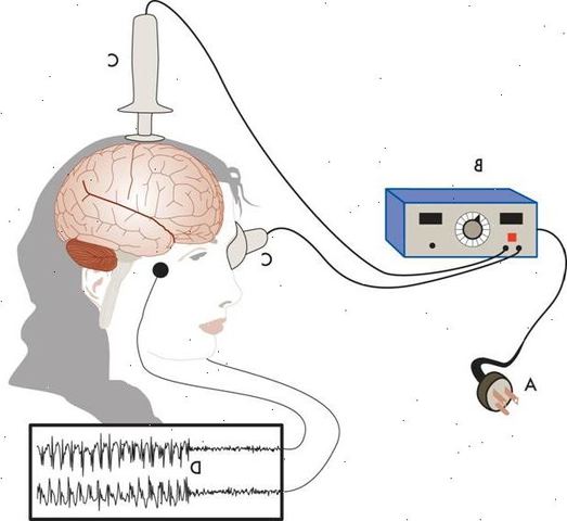 Terapia electroconvulsivante (TEC)