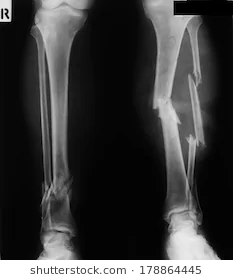 When i was 6 years old