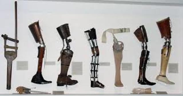 Prosthetic leg