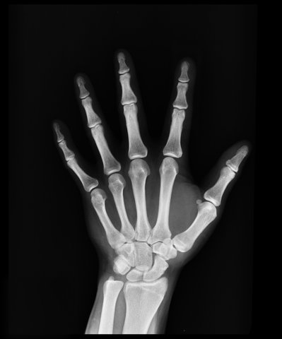 X-Rays