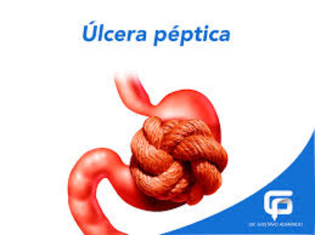 Primer ensayo relacionado con MBE.