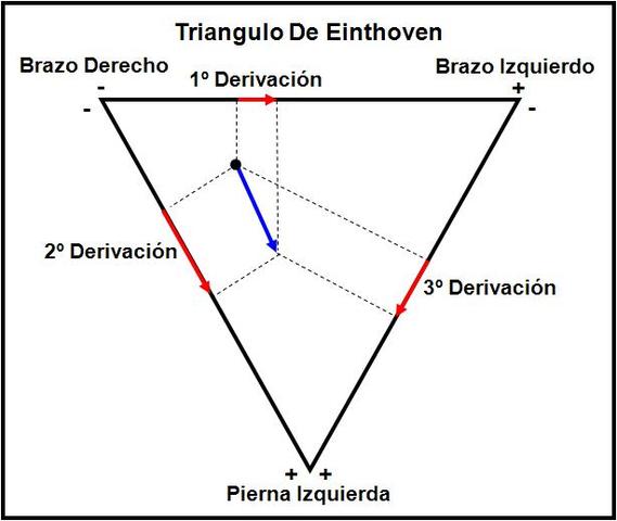 Triángulo de Einthoven