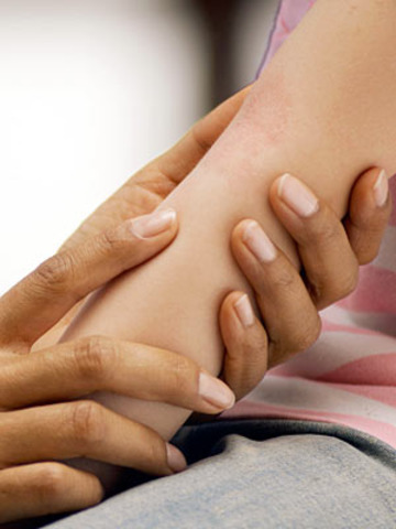 Kawasaki’s disease