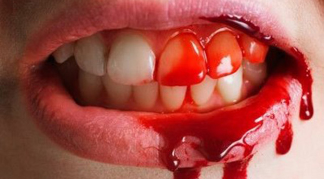 When I fell from my bed