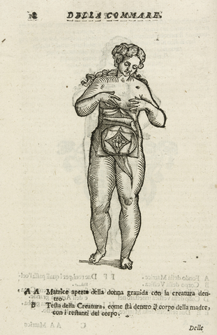 Manual on the Art of Childbirth by Madame du Coudary