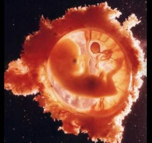 Révision de la révision