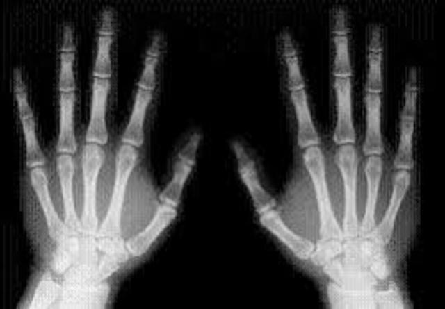 Fisica en 1895 (periodo moderno) (rayos X)