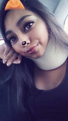 Me esguincé el cuello.