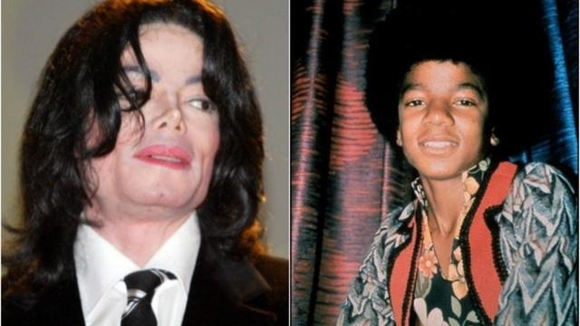 In 1993 Michael Jackson revealed his illness.