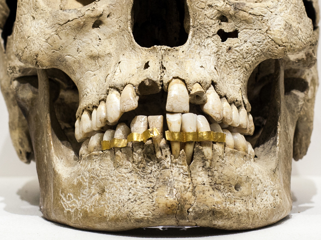 Dentistry in Mummies